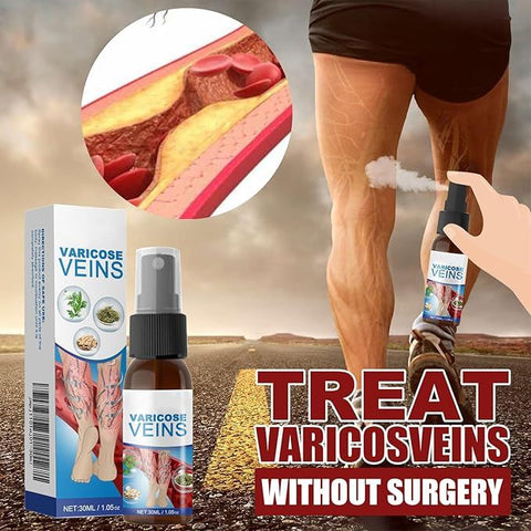 Varicose Vein Spray Herbal Body